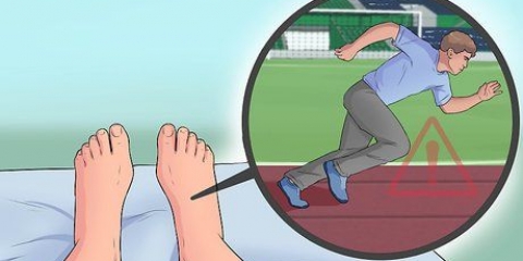 Behandling av plantar fasciit