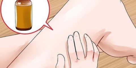 Behandla ringorm: kan det naturligt?
