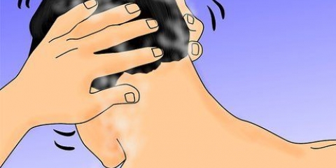Använder rogaine eller minoxidil