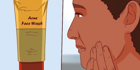 Bli av med en finne med aloe vera gel