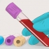 Ökad glomerulär filtreringshastighet