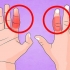Behandla ett brutet finger