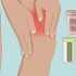 Behandling av tendinit i quadriceps