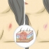 Ge en hickey