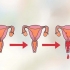 Bestäm din mest fertila dag för att bli gravid
