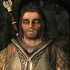 Healing lycanthropy i skyrim